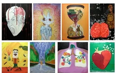 Painting exhibit to raise funds for children with cancer