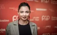 بازیگر فلسطینی با گلوله نیروهای اشغالگر صهیونیست زخمی شد