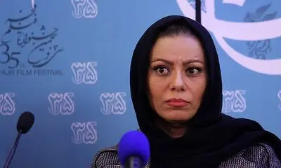 بهنوش صادقی: "پروتز" فیلمی سخت با زبان طنز است