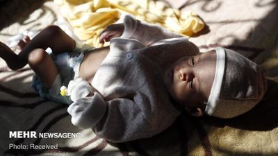 "Yemen's humanitarian disaster" photo fair to be held